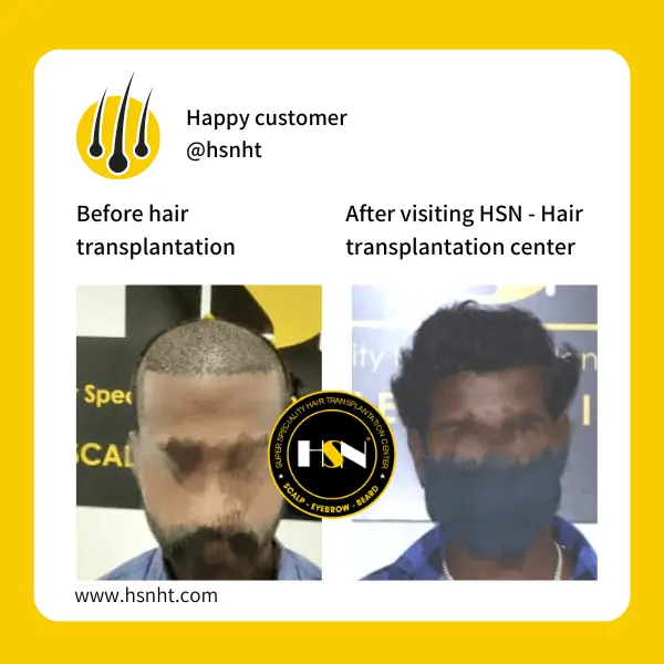 Corner Temples Restoration Before & After